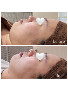 リリス(l’iris)/☆お客様ビフォーアフター☆