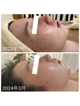 ルルボーテ(Loulou Beaute)/アンストレス×イラストリアス