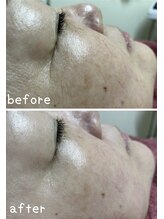 フェアリーヘア ニーナ(Fairy Hair Ni-na)/お客様ビフォーアフターお写真