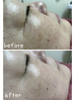 フェアリーヘア ニーナ(Fairy Hair Ni-na)/お客様ビフォーアフターお写真