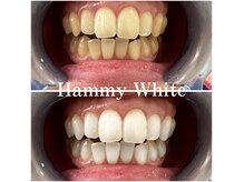 ハミーホワイト(Hammy White)の雰囲気（ホワイトニングで清潔な白い歯に！）