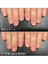 ネイルズ アヴァンティ(Nails Avanti)/自爪育成ネイルケア