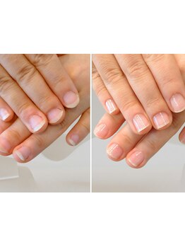 爪の悩みを解消できる（ケア含む）