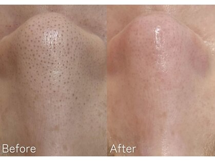 ミュー 岡崎店(mieux)の写真