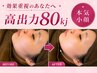 【再来限定】最新小顔|エステ版オンダ全顔+顎下 80kj