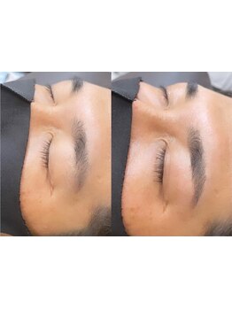 アイブロウメニューがあるサロン