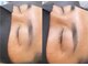 リンクス(links)の写真/【メンズも◎眉ワックス脱毛！】お顔の印象を左右する眉毛を綺麗に整えて美眉へ♪