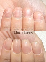 マリーロール 梅田店(Marie Laure)/深爪改善/自爪育成/ネイルケア