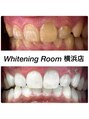 ホワイトニングルーム 横浜店(Whitening Room)/ホワイトニング専門店Whitening Room横浜店