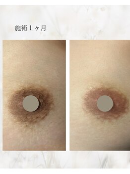 カルミア(kalmia)/ピンクケア