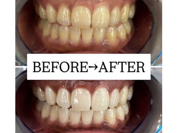 ホワイトニングサロン 宝塚/様々な悩みをお持ちの方も解決！