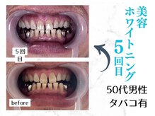 ルカノン(le canon)/ビジネスシーンを格上げする白さ