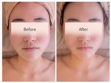 フィル 名駅店(fil)/f i l 小顔コルギ