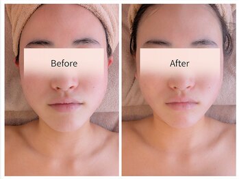 フィル 名駅店(fil)/f i l 小顔コルギ