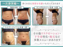 イデアルボーテ