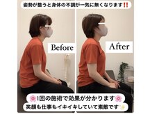 渋谷宮下パーク整体院 渋谷宮益坂整骨院/1回で変化を実感！体がスッキリ