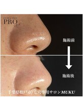 ムク(MUKU)/夏は皮脂の量が２倍！