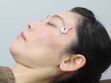 くるまざか鍼灸治療院 上野/眼精疲労にはコレ！