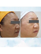 マリー エクラン/