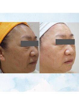 マリー エクラン/