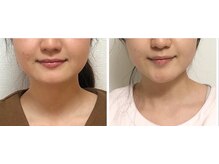 あいはな/長年のむくみもスッキリ