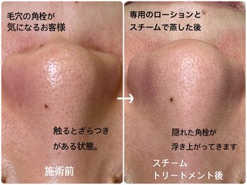 ルームエイトエイティスリー 新宿(R883)/鼻スチームトリートメントVol.1