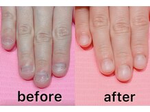 ネイル クロス ラニ 所沢店(Nail×Lani)/綺麗で自然な自爪になりました♪