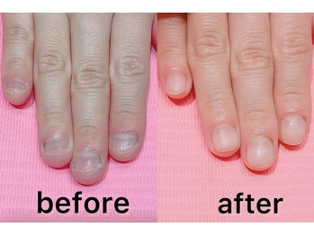 綺麗で自然な自爪になりました♪
