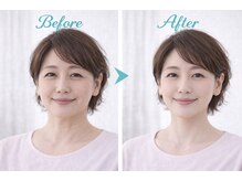 アプロ(Aphro)/若見えフェイス変化