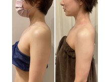 エイシスグロウ(asis glow.)/効果写真