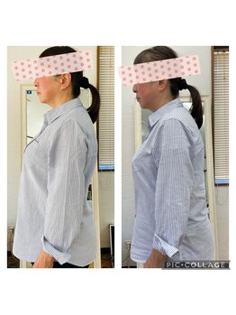 カレン(Current)/老け見え猫背撃退、最新美容整体