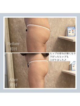 プレミドール(PREMIDOLL)/驚きの効果♪