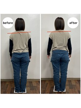 糸満メディカル整体/腕のコリをほぐして肩こり解消