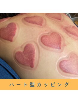 いつつのき/ハート型のカッピング