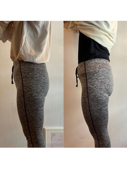 ドゥードル(doodle)/