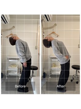 ナオル整体 恵比寿院(NAORU整体)/恵比寿/整体事例【骨盤矯正】