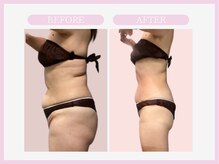 スリムライン 弘前店(The Slim Line)/before→after