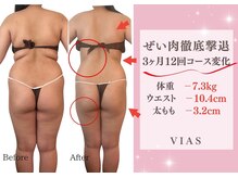ヴィアス(VIAS)