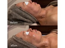 クレシア(CRECIA)の雰囲気（小顔も美肌も同時に叶う施術◎）