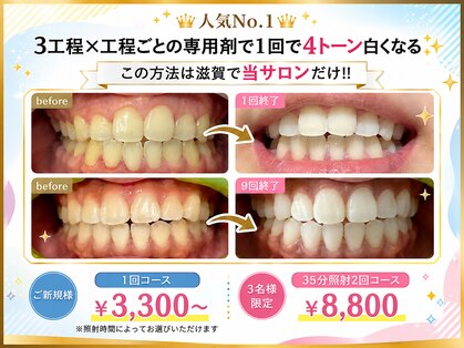 ワイズサロン(Y's salon)の写真