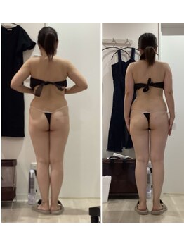 プラチナアース 守谷店(Platinum earth)/脚集中施術が得意な守谷店４