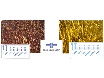 フェイシャルスタイリストサロン 高崎店(Facial Stylist Salon)/キメのケア例(11)