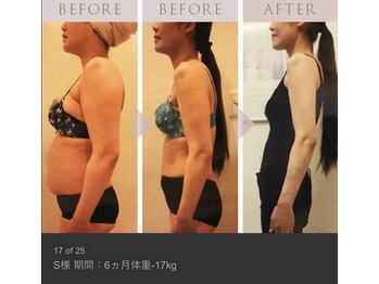 フェリーチェ 水戸店(Felice)/痩身/ダイエット/水戸/リンパ