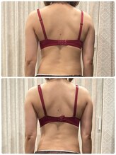 マカナ/癖になる！電流マッサージの効果