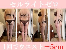 ラクワン(R coin)/セルZERO痩身