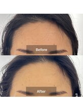 ハリオン 中目黒(HARI-ON)/初回　ビフォーアフター