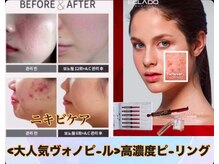 ミーヒ(MiHi)の雰囲気（肌トラブルを改善し、水光肌へ◎即効性あり）