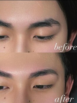イブ(Eve)の写真/メンズ専門店★≪全顔フェイシャルWAX脱毛+美眉WAX9800円≫WAX脱毛でうぶ毛と角質を取り除き明るい肌へ。