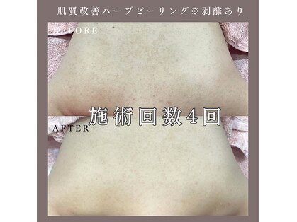 ベルミー(Bellmi)の写真