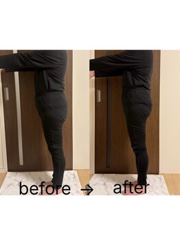 ヨサパーク ラウレアボディ 昭島店(YOSA PARK Laule'a Body)/お客様のbefore/after